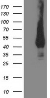 HEK293T cells were transfected with the pCMV6-ENTRY control (Left lane) or pCMV6-ENTRY MVK (Right lane) cDNA for 48 hrs and lysed
