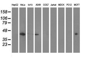 Western blot analysis of extracts (35ug) from 9 different cell lines by using anti-MVK monoclonal antibody (HepG2: human; HeLa: human; SVT2: mouse; A549: human; COS7: monkey; Jurkat: human; MDCK: canine; PC12: rat; MCF7: human)