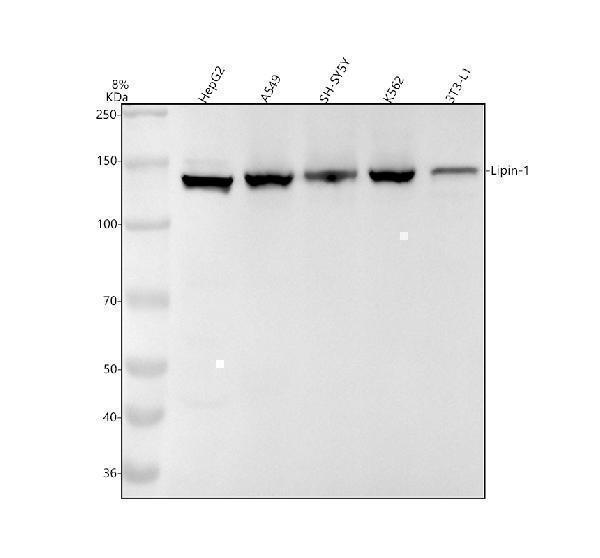 Western blot analysis of Lipin-1 using anti-Lipin-1 antibody (M02467-1)