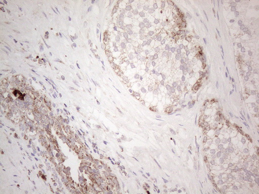 m02471 anti c19orf80 angptl8 mouse monoclonal antibody clone id oti1b12 ihc testing 4