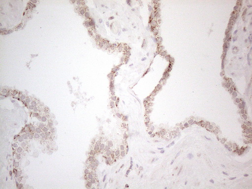 m02471 anti c19orf80 angptl8 mouse monoclonal antibody clone id oti1b12 ihc testing 5