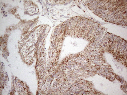 m02471 anti c19orf80 angptl8 mouse monoclonal antibody clone id oti1b12 ihc testing 6