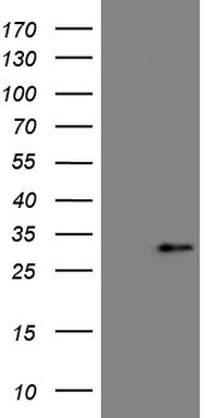HEK293T cells were transfected with the pCMV6-ENTRY control (Left lane) or pCMV6-ENTRY C19ORF80 (Right lane) cDNA for 48 hrs and lysed