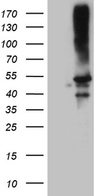 HEK293T cells were transfected with the pCMV6-ENTRY control (Left lane) or pCMV6-ENTRY CLP1 (Right lane) cDNA for 48 hrs and lysed