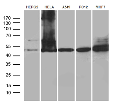Western blot analysis of extracts (35ug) from 5 cell lines by using anti-CLP1 monoclonal antibody (1:500)