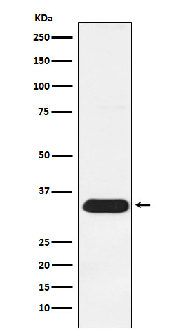 Western blot analysis of Syntenin expression in HeLa cell lysate