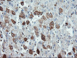 Immunohistochemical staining of paraffin-embedded Human liver tissue within the normal limits using anti-SDCBP mouse monoclonal antibody