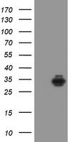 m02475 anti syntenin sdcbp mouse monoclonal antibody clone id oti2h6 wb testing 1