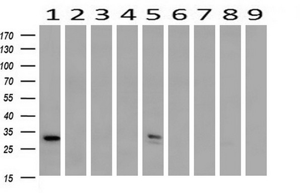 m02475 anti syntenin sdcbp mouse monoclonal antibody clone id oti2h6 wb testing 2