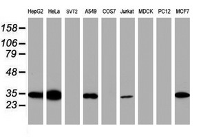 m02475 anti syntenin sdcbp mouse monoclonal antibody clone id oti2h6 wb testing 3