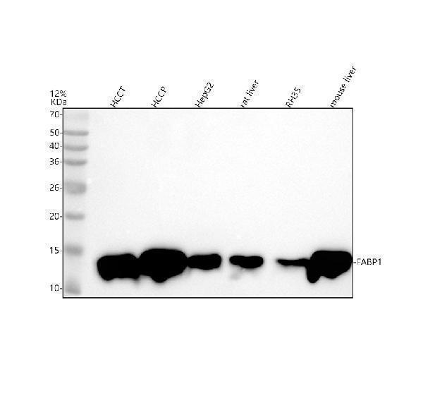 m02477 fabp primary antibodies wb testing 1