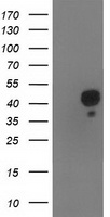 HEK293T cells were transfected with the pCMV6-ENTRY control (Left lane) or pCMV6-ENTRY NDEL1 (Right lane) cDNA for 48 hrs and lysed