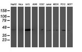 Western blot analysis of extracts (35ug) from 9 different cell lines by using anti-NDEL1 monoclonal antibody