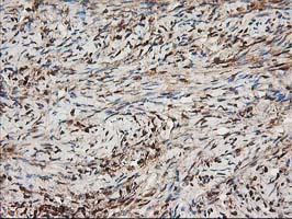 Immunohistochemical staining of paraffin-embedded Human Ovary tissue within the normal limits using anti-NDEL1 mouse monoclonal antibody
