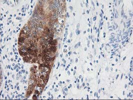 m02478 anti nudel ndel1 mouse monoclonal antibody clone id oti5e11 ihc testing 5