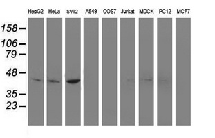 m02478 anti nudel ndel1 mouse monoclonal antibody clone id oti5e11 wb testing 2