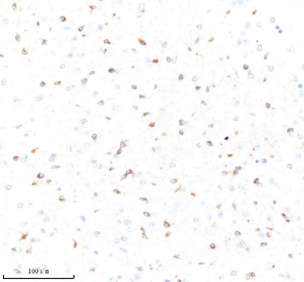 m02483 rapgef3 primary antibodies ihc testing 2