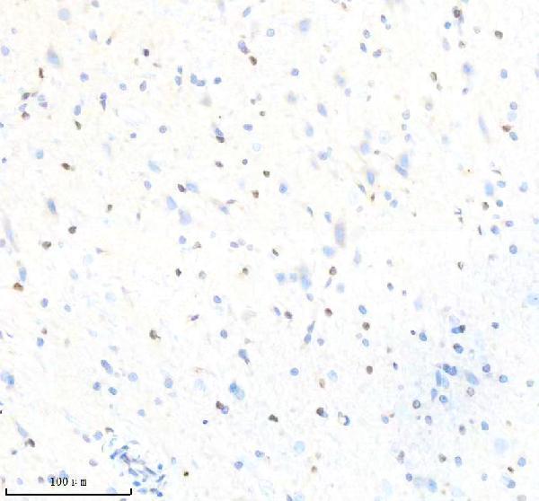 m02483 rapgef3 primary antibodies ihc testing 3