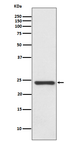 Western blot analysis of HSPB8/HSP22 expression in Human fetal heart lysate