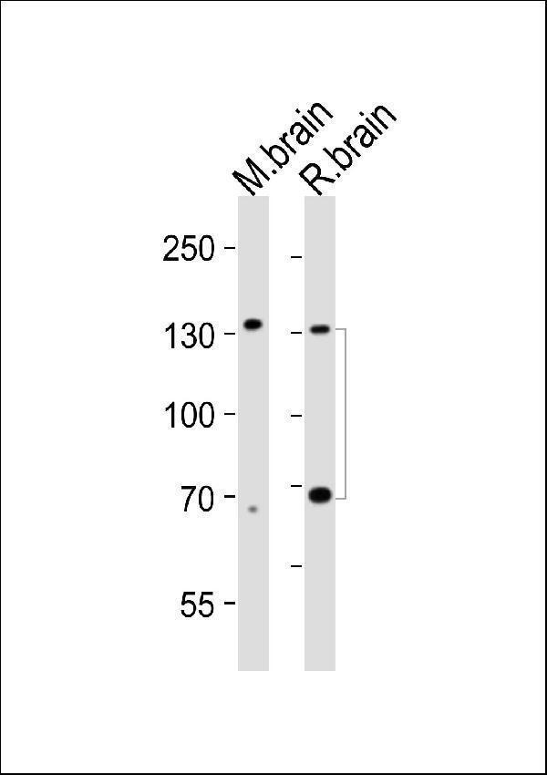 Western blot analysis of lysates from mouse brain, rat brain tissue lysate (from left to right), using Ntrk3 Antibody. M02502-1 was diluted at 1:1000 at each lane. A goat anti-mouse IgG H&L (HRP) at 1:3000 dilution was used as the secondary antibody. Lysates at 20microg per lane.