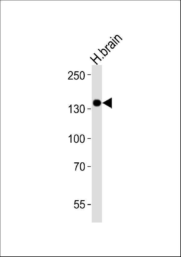 Western blot analysis of lysate from human brain tissue lysate, using Ntrk3 Antibody. M02502-1 was diluted at 1:1000. A goat anti-mouse IgG H&L(HRP) at 1:3000 dilution was used as the secondary antibody. Lysate at 20microg.