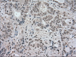 m02502 2 anti trkc ntrk3 mouse monoclonal antibody clone id oti2b8 ihc testing 10