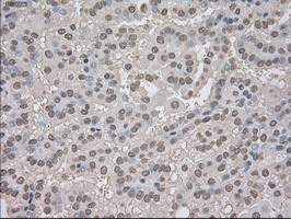 m02502 2 anti trkc ntrk3 mouse monoclonal antibody clone id oti2b8 ihc testing 11