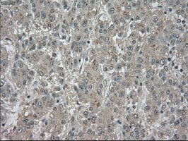 m02502 2 anti trkc ntrk3 mouse monoclonal antibody clone id oti2b8 ihc testing 12