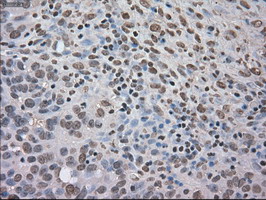 m02502 2 anti trkc ntrk3 mouse monoclonal antibody clone id oti2b8 ihc testing 4