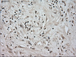 m02502 2 anti trkc ntrk3 mouse monoclonal antibody clone id oti2b8 ihc testing 5