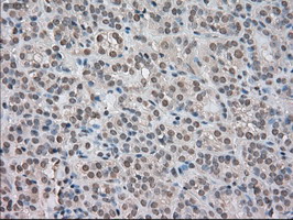 m02502 2 anti trkc ntrk3 mouse monoclonal antibody clone id oti2b8 ihc testing 6