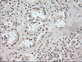 m02502 2 anti trkc ntrk3 mouse monoclonal antibody clone id oti2b8 ihc testing 7