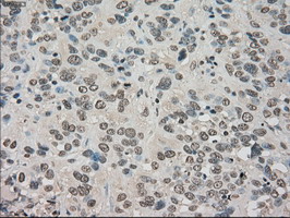 m02502 2 anti trkc ntrk3 mouse monoclonal antibody clone id oti2b8 ihc testing 8