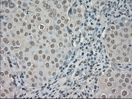 m02502 2 anti trkc ntrk3 mouse monoclonal antibody clone id oti2b8 ihc testing 9