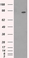 HEK293T cells were transfected with the pCMV6-ENTRY control (Left lane) or pCMV6-ENTRY NTRK3 (Right lane) cDNA for 48 hrs and lysed