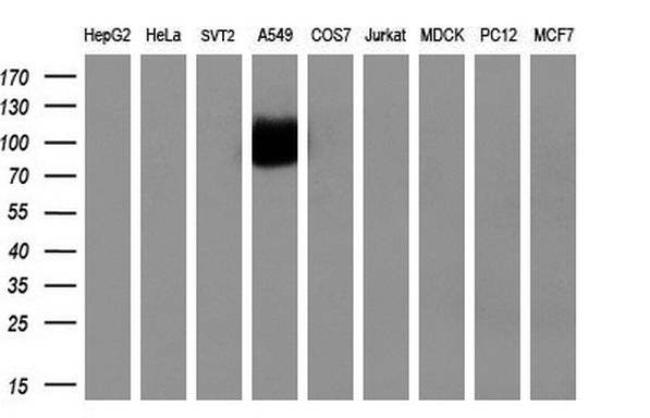 Western blot analysis of extracts (35ug) from 9 different cell lines by using anti-NTRK3 monoclonal antibody (HepG2: human; HeLa: human; SVT2: mouse; A549: human; COS7: monkey; Jurkat: human; MDCK: canine; PC12: rat; MCF7: human) (1:200)