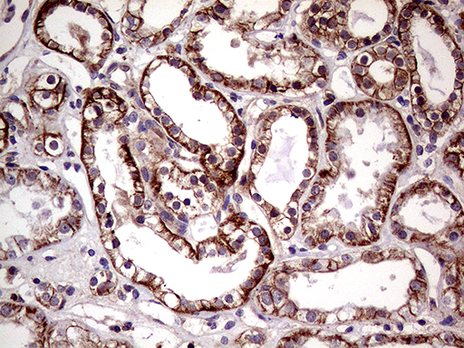 m02512 anti semaphorin 4d sema4d mouse monoclonal antibody clone id oti6g1 ihc testing 3