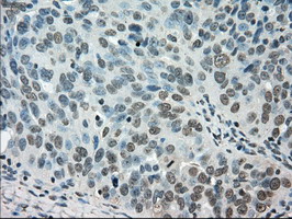 m02516 1 anti stk39 mouse monoclonal antibody clone id oti3c12 ihc testing 5