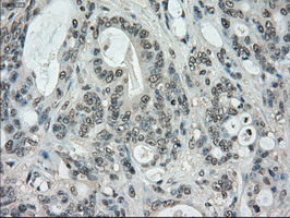 m02516 1 anti stk39 mouse monoclonal antibody clone id oti3c12 ihc testing 7