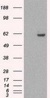 HEK293T cells were transfected with the pCMV6-ENTRY control (Left lane) or pCMV6-ENTRY STK39 (Right lane) cDNA for 48 hrs and lysed