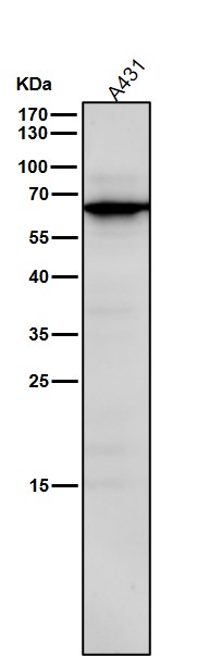 All lanes use the Antibody at 1:3K dilution for 1 hour at room temperature