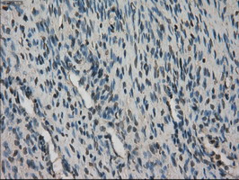 m02516 anti stk39 mouse monoclonal antibody clone id oti4e3 ihc testing 3