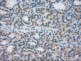 m02516 anti stk39 mouse monoclonal antibody clone id oti4e3 ihc testing 4