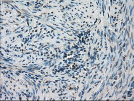 m02516 anti stk39 mouse monoclonal antibody clone id oti4e3 ihc testing 5