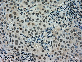 m02516 anti stk39 mouse monoclonal antibody clone id oti4e3 ihc testing 6