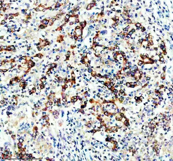 IHC analysis of DGAT1 using anti-DGAT1 antibody (M02522)