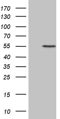 HEK293T cells were transfected with the pCMV6-ENTRY control (Left lane) or pCMV6-ENTRY ALAS2 (Right lane) cDNA for 48 hrs and lysed