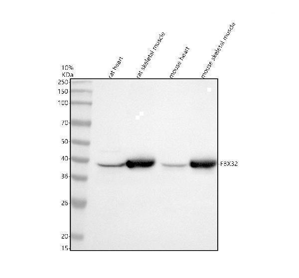 Western blot analysis of FBX32 using anti-FBX32 antibody (M02531-1)