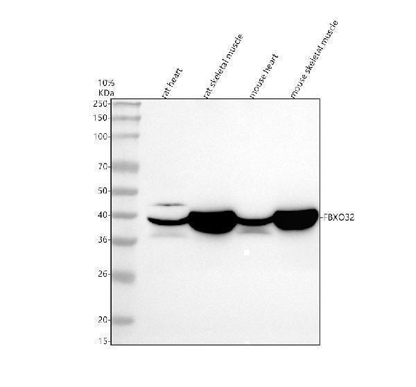 Western blot analysis of FBX32 using anti-FBX32 antibody (M02531-1)