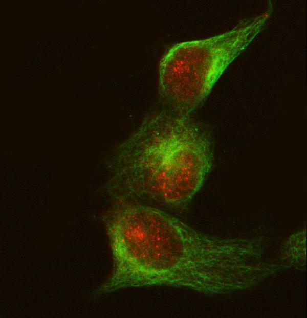 IF analysis of CRKII using anti-CRKII antibody (M02533-3) and anti-Beta Tubulin antibody (M01857-3)